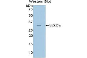 Detection of Recombinant GRAP2, Mouse using Polyclonal Antibody to GRB2 Related Adaptor Protein 2 (GRAP2) (GRAP2 Antikörper  (AA 20-262))