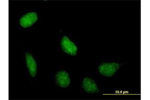 Immunofluorescence of purified MaxPab antibody to SIRT7 on HeLa cell. (SIRT7 Antikörper  (AA 1-400))