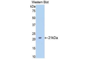 Western blot analysis of the recombinant protein. (Ferritin Mitochondrial Antikörper  (AA 65-227))