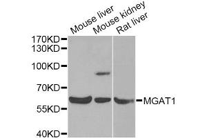 Western blot analysis of extracts of various cell lines, using MGAT1 Antibody (ABIN5975025) at 1/1000 dilution. (MGAT1 Antikörper)