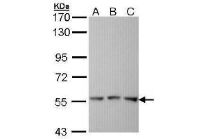 WB Image Sample (30 ug of whole cell lysate) A: Hela B: Hep G2 , C: Molt-4 , 7. (Fgr Antikörper  (C-Term))