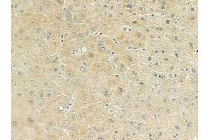 ABIN6260180 and ABIN6279191 at 1/100 staining human normal liver tissue by IHC-P.
