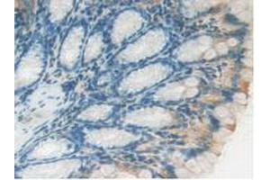IHC-P analysis of Mouse Intestine Tissue, with DAB staining. (LAMP2 Antikörper  (AA 295-410))