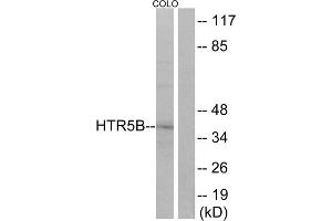 Western blot analysis of extracts from COLO cells, using HTR5B antibody. (HTR5B Antikörper  (C-Term))