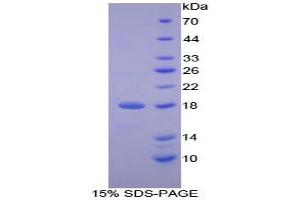 SDS-PAGE analysis of Human LTbR Protein. (LTBR Protein)