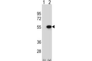 Western Blotting (WB) image for anti-Reptin,TIP49B,RUVB2 antibody (ABIN2995224) (Reptin,TIP49B,RUVB2 Antikörper)