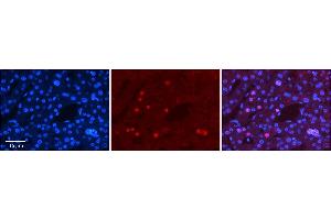 Rabbit Anti-ZNF3 Antibody      Formalin Fixed Paraffin Embedded Tissue: Human Adult Liver   Observed Staining: Nuclear in hepatocytes, moderate signal, low tissue distribution  Primary Antibody Concentration: 1:100  Secondary Antibody: Donkey anti-Rabbit-Cy3  Secondary Antibody Concentration: 1:200  Magnification: 20X  Exposure Time: 0. (ZNF3 Antikörper  (N-Term))