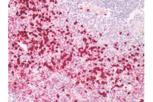Immunohistochemistry (IHC) image for anti-Prostaglandin E Synthase (PTGES) (Cytoplasmic Domain) antibody (ABIN1923233)