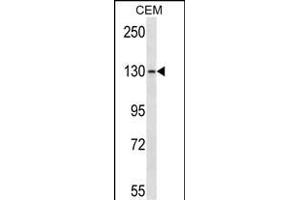 GRM1 Antibody (C-term) (ABIN657624 and ABIN2846620) western blot analysis in CEM cell line lysates (35 μg/lane). (Metabotropic Glutamate Receptor 1 Antikörper  (C-Term))