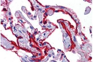 Human Lung: Formalin-Fixed, Paraffin-Embedded (FFPE) (SCUBE2 Antikörper  (Internal Region))