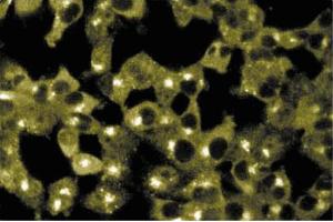 Immunofluorescence staining of ES-2 cells (Human ovary clear cell carcinoma, ATCC CRL-1978). (Sorting Nexin 2 Antikörper  (AA 15-137))