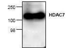 Image no. 1 for anti-Histone Deacetylase 7 (HDAC7) antibody (ABIN127244) (HDAC7 Antikörper)