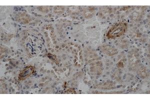 Immunohistochemistry of paraffin-embedded Mouse kidney using ACTA2 Polyclonal Antibody at dilution of 1:50 (Smooth Muscle Actin Antikörper)