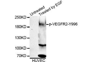 Western blot analysis of extracts of HUVEC cell line, using Phospho-VEGFR2-Y996 antibody (ABIN5995624). (VEGFR2/CD309 Antikörper  (pTyr996))