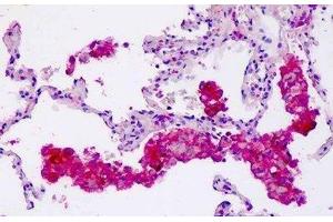 Human Lung, Macrophages: Formalin-Fixed, Paraffin-Embedded (FFPE) (Coronin 6 Antikörper  (AA 337-365))