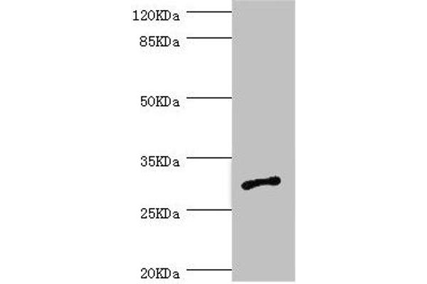 AGPAT2 Antikörper  (AA 199-278)