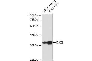 Western blot analysis of extracts of various cell lines, using DAZL antibody (ABIN6130243, ABIN6139416, ABIN6139417 and ABIN6218163) at 1:1000 dilution. (DAZL Antikörper  (AA 186-295))