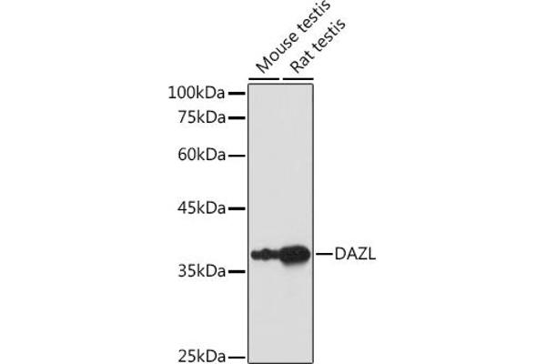 DAZL anticorps  (AA 186-295)