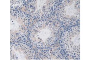 IHC-P analysis of Mouse Testis Tissue, with DAB staining. (LSR Antikörper  (AA 35-205))