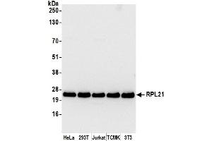 anti-Ribosomal Protein L21 (RPL21) (AA 1-50) antibody
