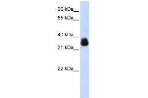 WB Suggested Anti-SCYE1 Antibody Titration:  0. (AIMP1 Antikörper  (Middle Region))