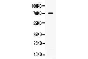 Western blot analysis of IL7R alpha expression in 22RV1 whole cell lysates ( Lane 1). (IL7R Antikörper  (C-Term))