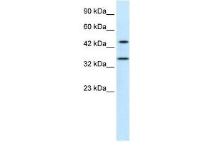 Human Jurkat; WB Suggested Anti-PNMA1 Antibody Titration: 0. (PNMA1 Antikörper  (Middle Region))