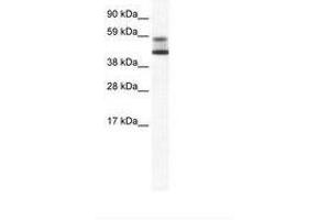 Image no. 1 for anti-Zinc Finger and BTB Domain Containing 7A (ZBTB7A) (AA 114-163) antibody (ABIN202736) (ZBTB7A Antikörper  (AA 114-163))