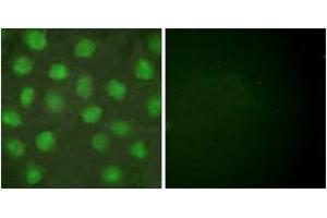 Immunofluorescence analysis of HuvEc cells, using Retinoid X Receptor gamma Antibody.