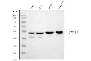 Western blot analysis of TRIP/TRAIP using anti-TRIP/TRAIP antibody (ABIN7599419). (TRAIP Antikörper  (AA 1-469))