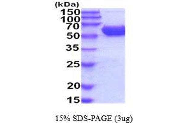 Carboxylesterase 2E (CES2E) (AA 27-559) (Active) protein (His tag)