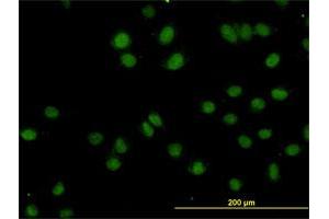 Immunofluorescence of monoclonal antibody to TOPORS on HeLa cell.
