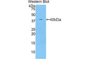 Western Blotting (WB) image for anti-Complement Component C7 (C7) (AA 725-838) antibody (ABIN3207981)