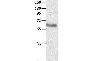 Western Blot analysis of Huamn fetal brain tissue using CRMP3 Polyclonal Antibody at dilution of 1:500 (DPYSL4 Antikörper)