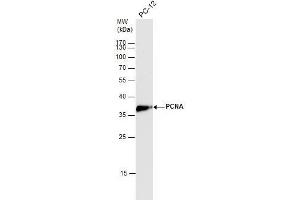WB Image PCNA antibody detects PCNA protein by western blot analysis.