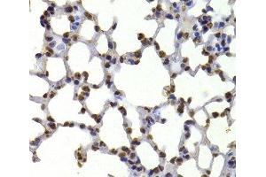 Immunohistochemistry of paraffin-embedded Mouse lung using CBX5 Polyclonal Antibody at dilution of 1:100 (40x lens). (CBX5 Antikörper)
