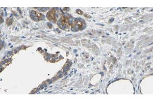 ABIN6275122 at 1/100 staining Human prostate tissue by IHC-P. (EIF3D Antikörper  (Internal Region))