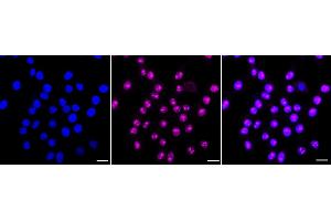 Immunocytochemical staining of HepG2 cells with LYN antibody (ABIN7800949), 1:1,000).