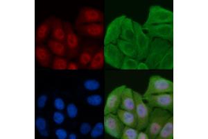 ABIN6261305 and ABIN6276929 staining Hela cells by IF/ICC.