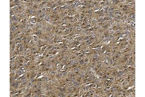 IHC analysis of ALDH1L1 using anti-ALDH1L1 antibody (ABIN7601093). (ALDH1L1 Antikörper  (AA 282-424))