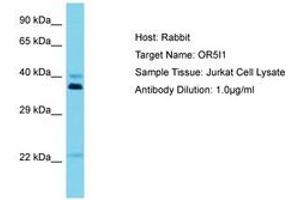 Image no. 1 for anti-Olfactory Receptor, Family 5, Subfamily I, Member 1 (OR5I1) (C-Term) antibody (ABIN6750583) (OR5I1 Antikörper  (C-Term))