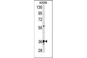 Image no. 1 for anti-Glyceraldehyde-3-Phosphate Dehydrogenase (GAPDH) (C-Term) antibody (ABIN360237) (GAPDH Antikörper  (C-Term))