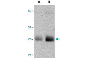 Western blot analysis of GBAS in human skeletal muscle tissue lysate with GBAS polyclonal antibody  at (A) 0. (GBAS Antikörper  (N-Term))