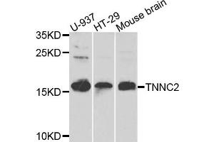 Western blot analysis of extracts of various cells, using TNNC2 antibody. (TNNC2 Antikörper)