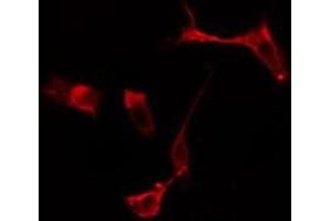 ABIN6275092 staining  Hela cells by IF/ICC. (RFWD2 Antikörper  (Internal Region))