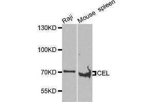 Western blot analysis of extracts of Raji and mouse spleen cells, using CEL antibody. (Cholesterol Esterase Antikörper)