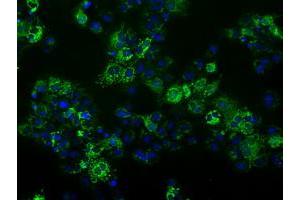 Anti-FAHD2A mouse monoclonal antibody (ABIN2453018) immunofluorescent staining of COS7 cells transiently transfected by pCMV6-ENTRY FAHD2A (RC211128). (FAHD2A Antikörper)