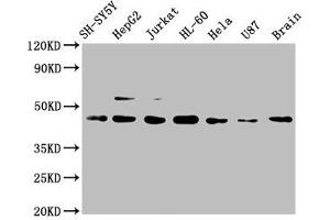 Western Blot Positive WB detected in: SH-SY5Y whole cell lysate, HepG2 whole cell lysate, Jurkat whole cell lysate, HL-60 whole cell lysate, Hela whole cell lysate, U87 whole cell lysate, Mouse brain tissue All lanes: CCR9 antibody at 1 μg/mL Secondary Goat polyclonal to rabbit IgG at 1/50000 dilution Predicted band size: 43, 41 KDa Observed band size: 43 KDa (Rekombinanter CCR9 Antikörper)