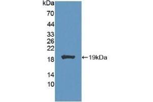Detection of Recombinant CA7, Mouse using Polyclonal Antibody to Carbonic Anhydrase VII (CA7) (CA7 Antikörper  (AA 58-217))