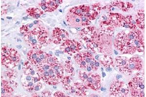 Immunohistochemistry (Formalin-fixed Paraffin-embedded Sections) (IHC (fp)) image for anti-ATP-Binding Cassette, Sub-Family B (MDR/TAP), Member 1 (ABCB1) (AA 863-912) antibody (ABIN6745748)